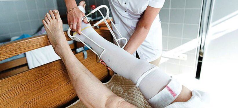 compression hosiery for the treatment of varicose veins